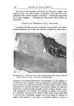 giornale/UM10004251/1935/unico/00000330