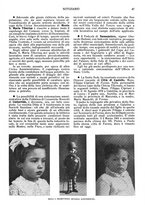 giornale/UM10007474/1934/unico/00000175