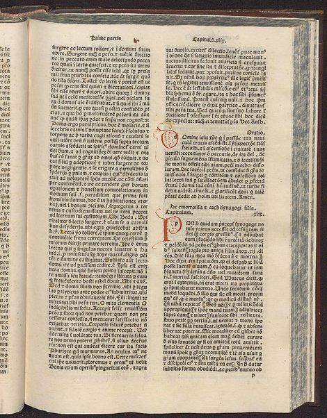 Incipit liber de vita iesu christi non ille de infantia salvatoris apocriphus sed ex serie evangelice historie collectus [1]