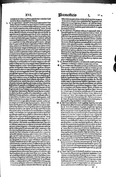 [Dictionnaire universel de medecine, de chirurgie, de chymie, de botanique, d'anatomie, de pharmacie, d'histoire naturelle, &c. Précédé d'un Discours historique sur l'origine & les progres de la medecine. Traduit de l'anglois de m. James par m.rs Diderot, Eidous & Toussaint. Revu, corrigé & augmenté par m. Julien Busson ... Tome premier [-sixieme]] 5