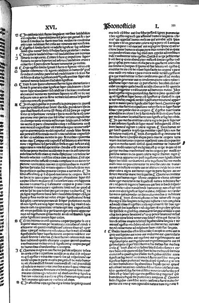 [Dictionnaire universel de medecine, de chirurgie, de chymie, de botanique, d'anatomie, de pharmacie, d'histoire naturelle, &c. Précédé d'un Discours historique sur l'origine & les progres de la medecine. Traduit de l'anglois de m. James par m.rs Diderot, Eidous & Toussaint. Revu, corrigé & augmenté par m. Julien Busson ... Tome premier [-sixieme]] 5